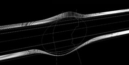 Requalification Pont du Lion